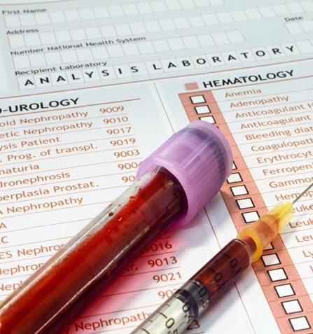 Diagnosis of Low Platelet Count